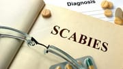 Suffering from scabies? Discover symptoms, causes, and remedial solutions
